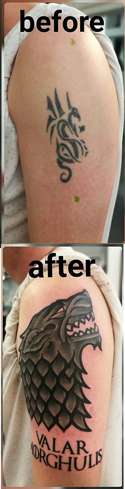 girl with dragon tattoo coveroup,Dublin tattoo removal, laser tattoo removal